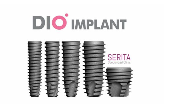 برند ایمپلنت کره ای دیو dio