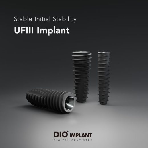 ایمپلنت کره ای دیو dio - تکنولوژی جدید