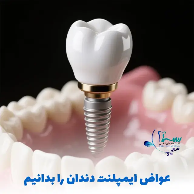عوارض ایمپلنت دندان - تصویر ایمپلنت دندان