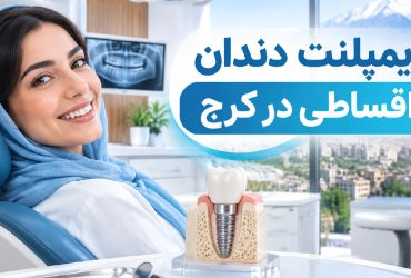 ایمپلنت دندان اقساطی در کرج