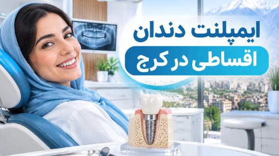ایمپلنت دندان اقساطی در کرج