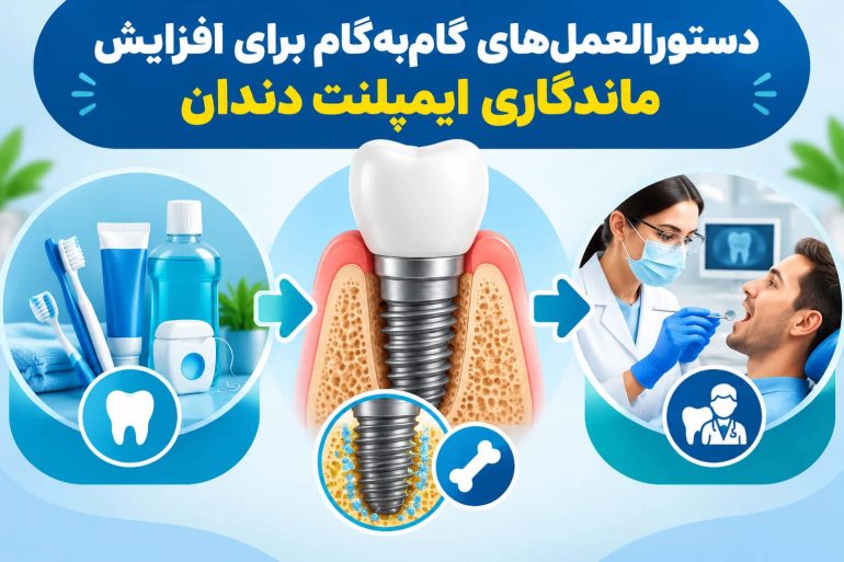 دستورالعمل_های گام_به_گام برای افزایش ماندگاری ایمپلنت دندان (1)
