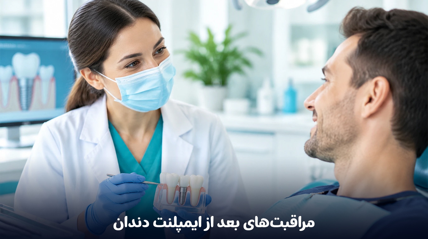 مراقبت‌های بعد از ایمپلنت دندان