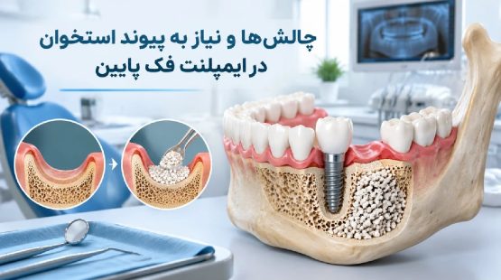 چالشها و نیاز به پیوند استخوان در فک پایین