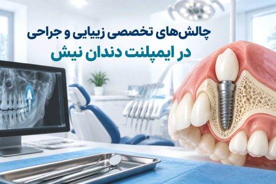 چالشهای تخصصی زیبایی و جراحی در ایمپلنت دندان نیش